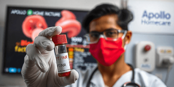 Prothrombin Time & INR